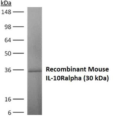 Western Blot: IL-10R alpha Antibody (RM0101-9E12)Azide and BSA Free [NBP1-22459]