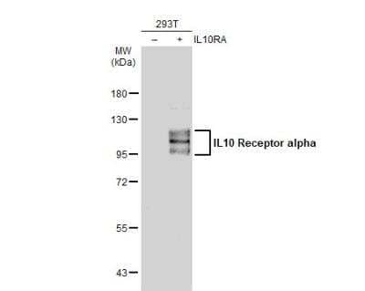 Western Blot: IL-10R alpha Antibody [NBP2-16941]