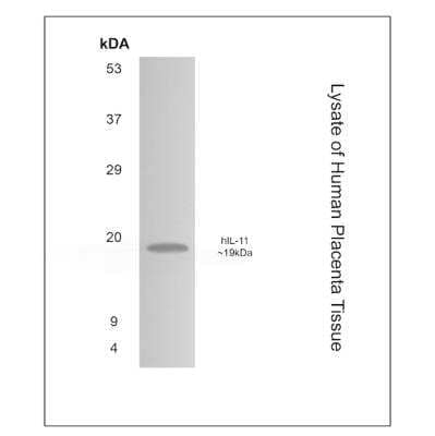 Western Blot: IL-11 Antibody (MM0361-9T27)Azide and BSA Free [NBP2-11655]