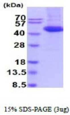 SDS-PAGE: Recombinant Rat IL-11R alpha His Protein [NBP2-52394]