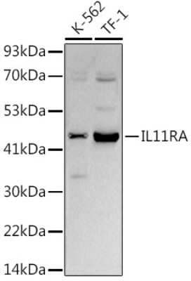 Western Blot: IL-11R alpha Antibody (10Z3S9) [NBP3-16809]