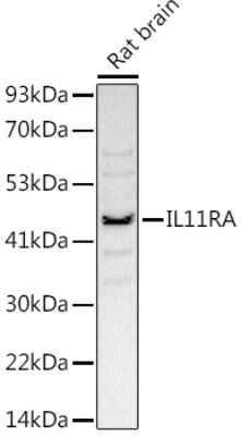 Western Blot: IL-11R alpha Antibody (10Z3S9) [NBP3-16809]