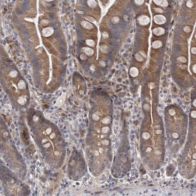 Immunohistochemistry-Paraffin: IL-11R alpha Antibody [NBP2-31997]