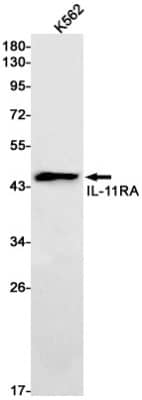 Western Blot: IL-11R alpha Antibody (S08-2J3) [NBP3-19662]