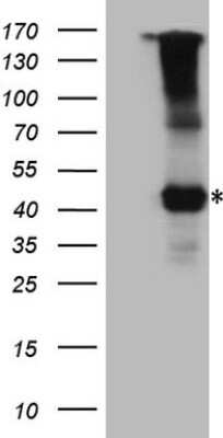 Western Blot: IL-12 R beta 1 Antibody (OTI1A6) [NBP2-45392]