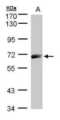 Western Blot: IL-12 R beta 1 Antibody [NBP1-32449]