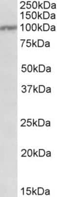 Western Blot: IL-12 R beta 1 Antibody [NBP1-49875]