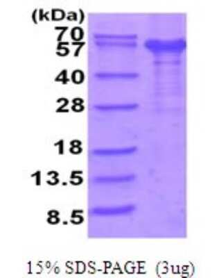 SDS-PAGE: Recombinant Human IL-12 R beta 1 His Protein [NBP2-51952]