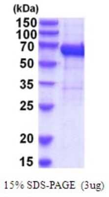 SDS-PAGE: Recombinant Human IL-12 R beta 1 His Protein [NBP2-52085]