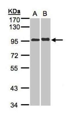 Western Blot: IL-12 R beta 2 Antibody [NBP1-32558]