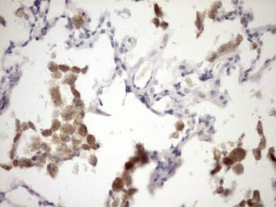 Immunohistochemistry: IL-12 p70/IL-12A Antibody (OTI2A8) [NBP2-46050]