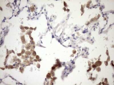 Immunohistochemistry: IL-12 p70/IL-12A Antibody (OTI2A8) - Azide and BSA Free [NBP2-71031]