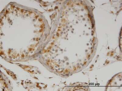 Immunohistochemistry-Paraffin: IL-13 Antibody (2B5) [H00003596-M07]