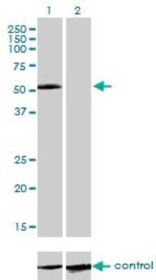 Western Blot: IL-13R alpha 2 Antibody (2E10) [H00003598-M01]