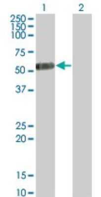 Western Blot: IL-13R alpha 2 Antibody (2E10) [H00003598-M01]