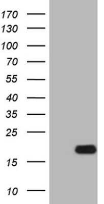 Western Blot: IL-15 Antibody (OTI2B4) [NBP2-45399]