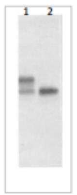 Western Blot: IL-17/IL-17A Antibody (408H6.01/mAb25) [DDX0336P-100]