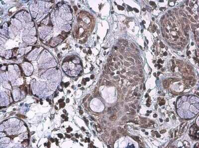 Immunohistochemistry-Paraffin: IL-17/IL-17A Antibody [NBP3-13294]