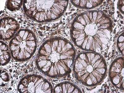 Immunohistochemistry-Paraffin: IL-17/IL-17A Antibody [NBP3-13294]