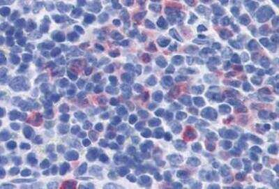 Immunohistochemistry-Paraffin: IL-17/IL-17A Antibody (TC11-18H10) - Azide and BSA Free [NBP1-72027]