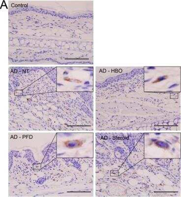 Immunohistochemistry-Paraffin: IL-17/IL-17A Antibody (TC11-18H10) - Azide and BSA Free [NBP1-72027]