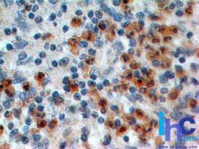 Immunohistochemistry-Paraffin: IL-17RA/IL-17R Antibody (49M4D2) - Azide Free [NBP2-25271]