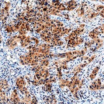 Immunohistochemistry: IL-17RB Antibody (938923) - Azide and BSA Free [MAB12073]
