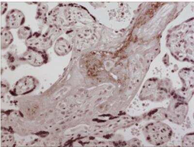 Immunohistochemistry-Paraffin: IL-17RB Antibody (MM0374-5P14) - Azide and BSA Free [NBP2-11673]