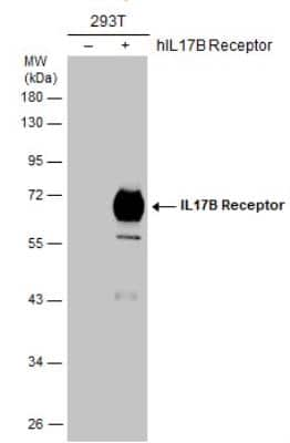 Western Blot: IL-17RB Antibody [NBP2-43767]