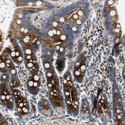 Immunohistochemistry-Paraffin: IL-17RC Antibody [NBP1-83112]