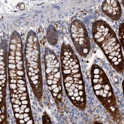 Immunohistochemistry: IL-17RD/SEF Antibody [NBP2-48711]