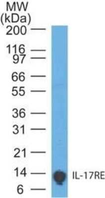 Western Blot: IL-17RE Antibody (46N7E3)Azide Free [NBP2-27367]