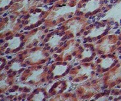 Immunohistochemistry-Paraffin: IL-17RE Antibody (46N7E3) [NBP2-27368]