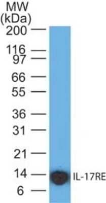 Western Blot: IL-17RE Antibody (46N8G7)Azide Free [NBP2-27366]