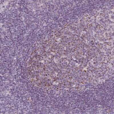 Immunohistochemistry: IL-17C Antibody [NBP2-39046]