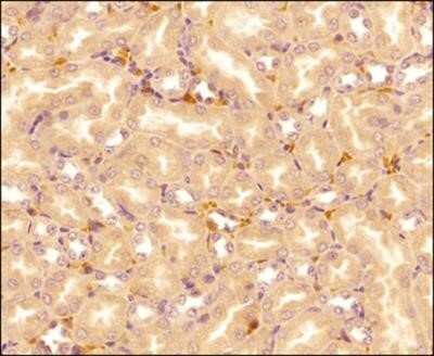 Immunohistochemistry: IL-17E/IL-25 Antibody (68C1039.2) - Azide Free [NBP2-33223]