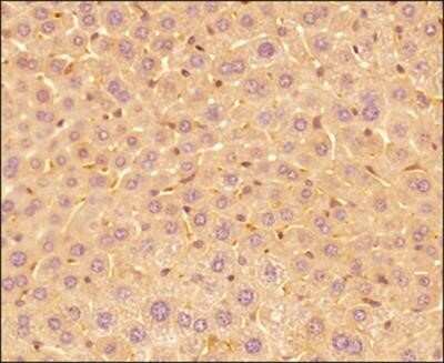 Immunohistochemistry: IL-17E/IL-25 Antibody (68C1039.2) - Azide Free [NBP2-33223]