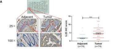 Immunohistochemistry: IL-17E/IL-25 Antibody (68C1039.2) - BSA Free [NB100-56541]