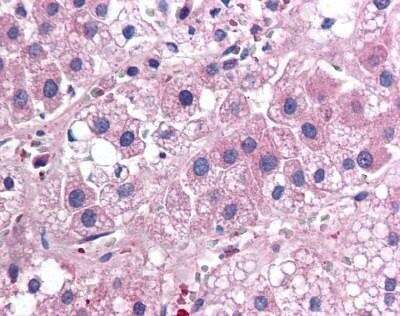 Immunohistochemistry-Paraffin: IL-17E/IL-25 Antibody (68C1039.2) - BSA Free [NB100-56541]