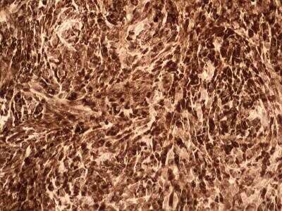 Immunohistochemistry: IL-17F Antibody (4H1629.1) - Azide and BSA Free [NBP2-80796]