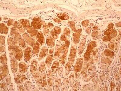 Immunohistochemistry: IL-17F Antibody (4H1629.1) - Azide and BSA Free [NBP2-80796]