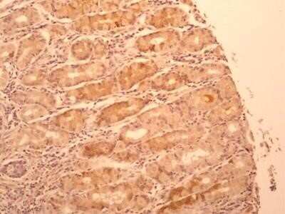 Immunohistochemistry-Paraffin: IL-17F Antibody (4H1629.1) - Azide and BSA Free [NBP2-80796]