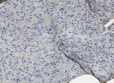 Immunohistochemistry-Paraffin: IL-17RB Antibody [NBP1-85450]