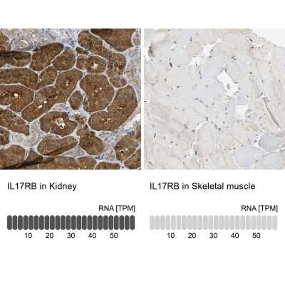 Immunohistochemistry-Paraffin: IL-17RB Antibody [NBP1-85450]