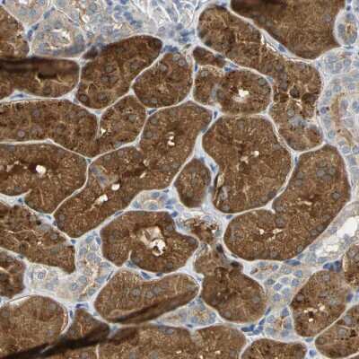 Immunohistochemistry-Paraffin: IL-17RB Antibody [NBP1-85450]