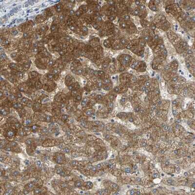Immunohistochemistry-Paraffin: IL-17RB Antibody [NBP1-85450]