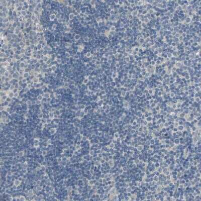 Immunohistochemistry-Paraffin: IL-17RB Antibody [NBP1-85450]