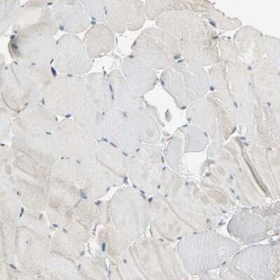 Immunohistochemistry-Paraffin: IL-17RB Antibody [NBP1-85450]