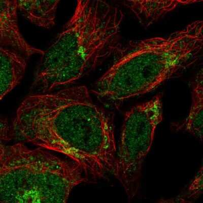 Immunocytochemistry/ Immunofluorescence: IL-17RD/SEF Antibody [NBP2-47420]