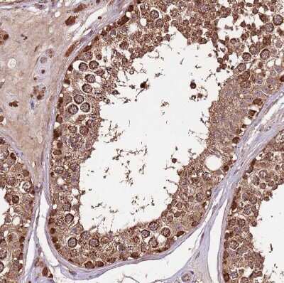 Immunohistochemistry-Paraffin: IL-17RD/SEF Antibody [NBP2-47420]